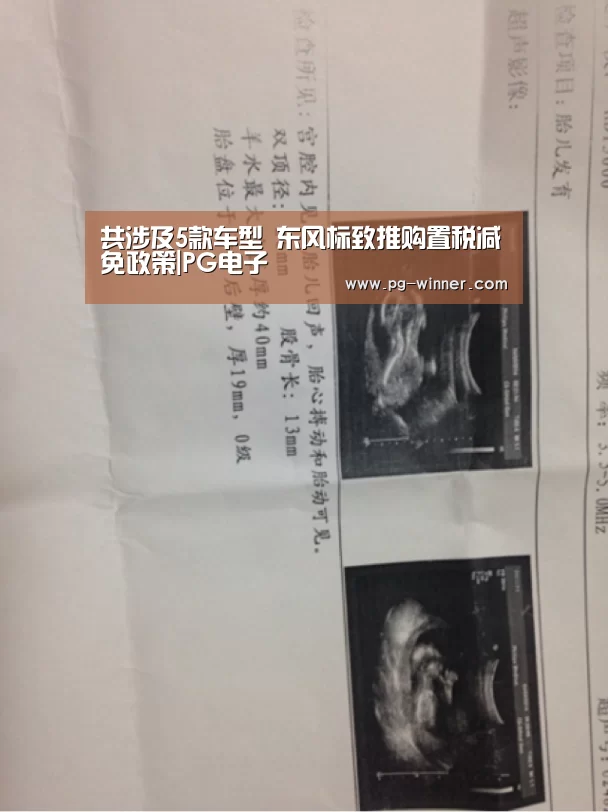 共涉及5款车型 东风标致推购置税减免政策|PG电子(图3) PG棋牌